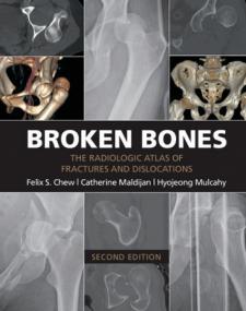 Broken Bones- The Radiologic Atlas of Fractures and Dislocations, 2nd Edition