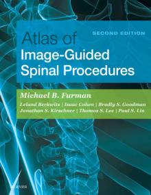 Atlas of Image-Guided Spinal Procedures, 2nd Edition