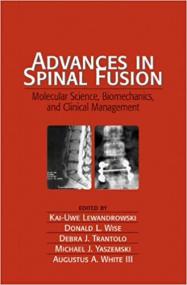 Advances in Spinal Fusion- Molecular Science, BioMechanics, and Clinical Management