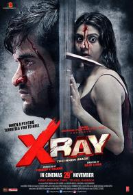 X Ray The Inner Image <span style=color:#777>(2019)</span> 720p HDRip - [ Hindi +Tamil + Kannada] - x264 - AAC -1GB