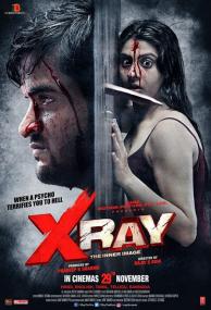 X Ray The Inner Image <span style=color:#777>(2019)</span>[720p HDRip - [Tamil + Hindi + Kannada] - x264 - 1GB]