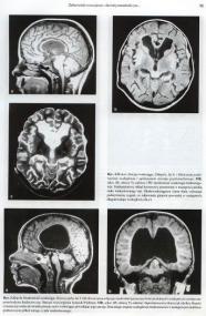 Radiologia, Diagnostyka obrazowa, USG, Tomografia, MR - paczka HQ DJVU PL