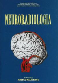 J  Walecki - Neuroradiologia  djvu