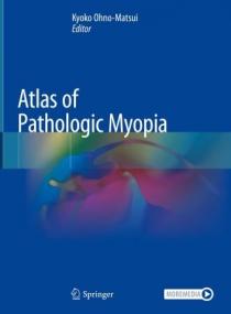 [ TutGee.com ] Atlas of Pathologic Myopia (True PDF, EPUB)