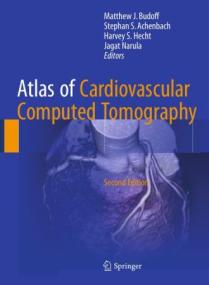 [ CourseBoat.com ] Atlas of Cardiovascular Computed Tomography, Second Edition