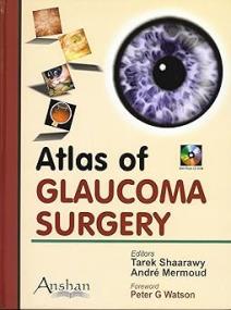 Atlas of Glaucoma Surgery