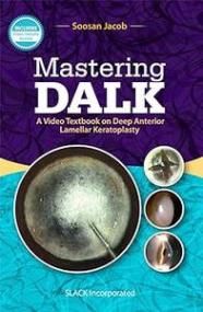 [ CourseWikia com ] Mastering DALK - A Video Textbook on Deep Anterior Lamellar Keratoplasty
