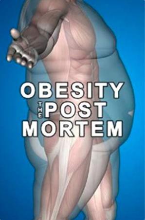 Obesity The Post Mortem<span style=color:#777> 2016</span> WEBRip XviD MP3-XVID